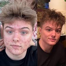 How to contact Dean Fearon from Barberton, OH?