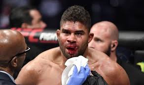 See more of alistair overeem on facebook. Ufc Star Alistair Overeem Suffers Horrific Cut In Ko Loss Nastiest S T I Ve Seen Ufc Sport Express Co Uk