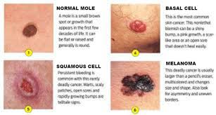 Skin Cancer Dermatologist In Bethesda Md