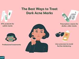 Firstly, wearing a sunscreen can be a huge plus. Post Inflammatory Hyperpigmentation And Acne