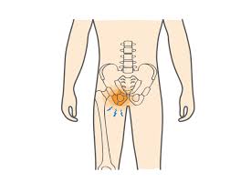 However, you can minimise the risk by observing the following guidelines: Pubic Ramus Fracture Upswing Health