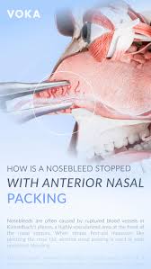 Image result for Nasal Packing