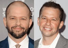 Male Celebrities Who Wear Toupees and Wigs Due to Hair Loss