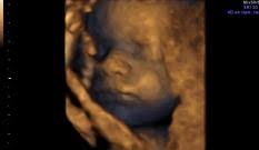 El avance de tu bebé a las 31 semanas de embarazo. Semana 31 De Embarazo Inatal El Embarazo Semana A Semana