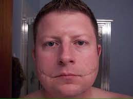 10 years ago10 years ago. The Glasgow Smile The Black Ted Bundy Talks True Crime Facebook