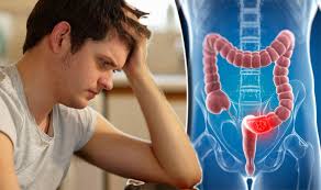 Pappou, a colorectal surgeon at memorial sloan kettering cancer center in new york. Bowel Cancer Risk Would You Report These Symptoms Of The Disease Express Co Uk