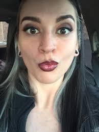 Not the best photo but does this look like a lip tie?