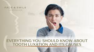 Image result for Tooth Luxation