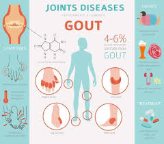 Image result for gout symptoms toe