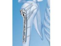 3.5 mm LCP Periarticular Proximal Humerus