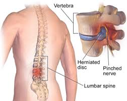 Each internal organ of the body plays a specific role in the organism. Back Injury Treatment In Nj Back Injury Doctor Specialist