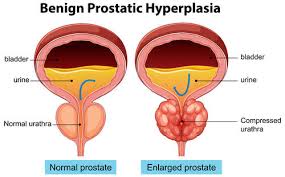 Image result for Prostate Anatomy