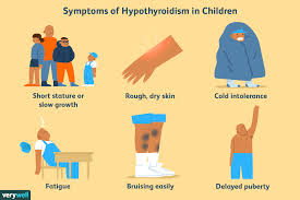 Radiation exposure during childhood (tumor incidence will increase as the. Symptoms Of Thyroid Disease In Children