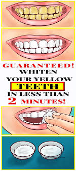 Pin On How To Fix A Bad Tooth