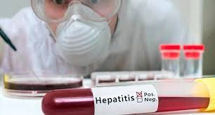 Hepatita cronica cu virus c. Espana Ha Tratado A Mas De 130 000 Pacientes De Hepatitis C Desde 2015 Gaceta Medica