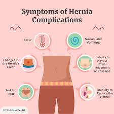 Image result for stomach hernia symptoms