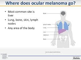 Breast cancer is the second most common cancer found in women — after skin cancer — but that doesn't mean men aren't at risk as well. How To Approach Systemic Treatment For Metastatic Disease
