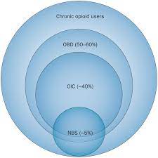 Diagnosis And Treatment Of Narcotic Bowel Syndrome Nature Reviews Gastroenterology Hepatology