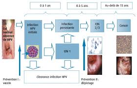 Aceasta boala reprezinta inmultirea anormala vaccinarea se face in scop profilactic, adica este folosit in prevenirea infectiei. Prevention Du Cancer Du Col Uterin Ii Vaccination Hpv Prophylactique Connaissances Actuelles Modalites Pratiques Et Nouveaux Enjeux Sciencedirect