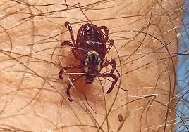 Image result for Tick Paralysis