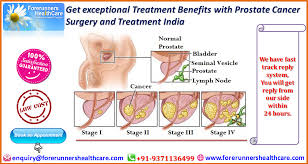 Image result for Prostate Cancer Management