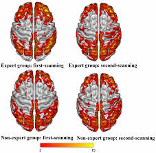 Check spelling or type a new query. Frontiers A Reduction In Video Gaming Time Produced A Decrease In Brain Activity Human Neuroscience