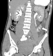 Image result for Genitourinary Trauma