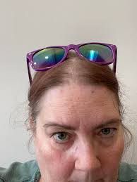 Using Qulipta and Nurtec for migraine prevention and breakthroughs?