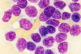 Image result for Anemia angolensis