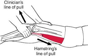 Image result for Lachman Test