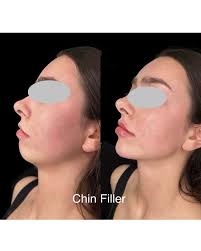 Nam Vu, Board certified ARNP (@sonam_health_and_aesthetics) • Instagram  photos and videos