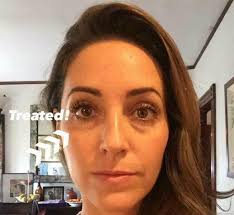 What is the best eye cream for dark circles?