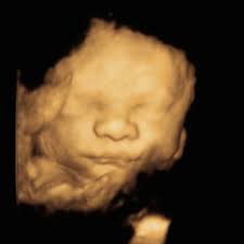 Kayla Morgan and Lance Morrison's Baby Registry at Babylist