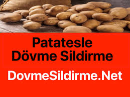 Patatesle Dovme Silme Nasil Yapilir Dovme Silme Dovme Sildirme Lazerle Dovme Cikarma