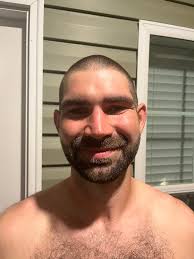 Who won the no shave contest?