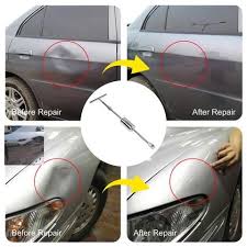 We remove all kinds dent without damaging any paint in bangalore. Us 91 Paintless Dent Repair Kit M 57diy Com In 2021 Dent Repair Car Dent Repair Repair