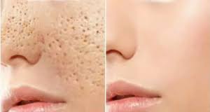 Pin On Beaute