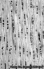 Image result for Brachystegia spiciformis × microphylla