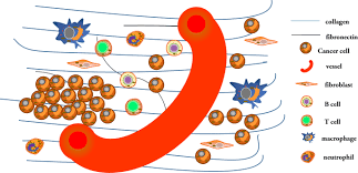 Please laugh, my friends are watchingwe're gonna be rich! The Role Of Collagen In Cancer From Bench To Bedside Journal Of Translational Medicine Full Text