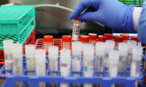 A group for those in the uk and ireland who have, or believe they have, direct experience of covid, or is worried for someone they care about. New Covid Variant With Potentially Worrying Mutations Found In Uk Coronavirus The Guardian