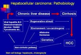 Hepatocellular Carcinoma Hcc Practice Essentials Anatomy