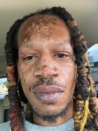 At work about to change me propane tank out and noticed this someone Drew a  face