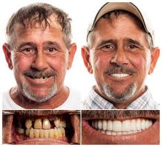 TOP 10 BEST Sleep Study in Chattanooga, TN