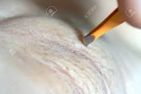 In 5 minutes, remove unwanted armpit hair permanently, unwanted hair will never grow back. Close Up Hand Of Woman Plucking Armpit Hair Removal Beauty Stock Photo Picture And Royalty Free Image Image 132142260