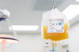 Image result for Plasma Transfusion