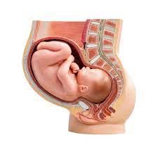 Das kann man tun wenn der vorfuß des babys sich nach innen gedreht hat und die fußspitzen sind nach. Sichelfuss Fussfehlstellung Bei Babys