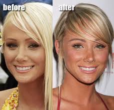 Charleston is going through a significant transition, and the cast of southern charm is taking the journey one day at a time. Celebrity Plastic Surgery Before After 56 Pics Celebrity Surgery Plastic Surgery Celebrity Plastic Surgery