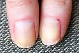 Maybe you would like to learn more about one of these? Itchy Cuticles Why It Happens And What To Do Beautygab Com