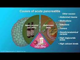 Pin On Pancreatitis