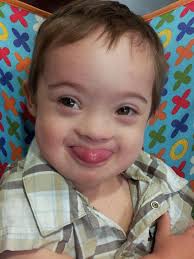 How Your Child Can Be Featured In A Babble Down Syndrome Awareness Article
